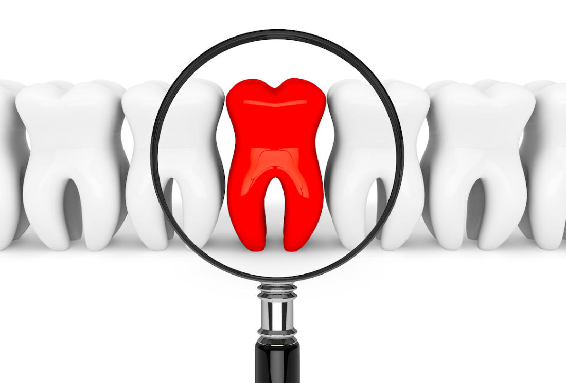 Find and Eliminate Tooth Pain Clearwater FL